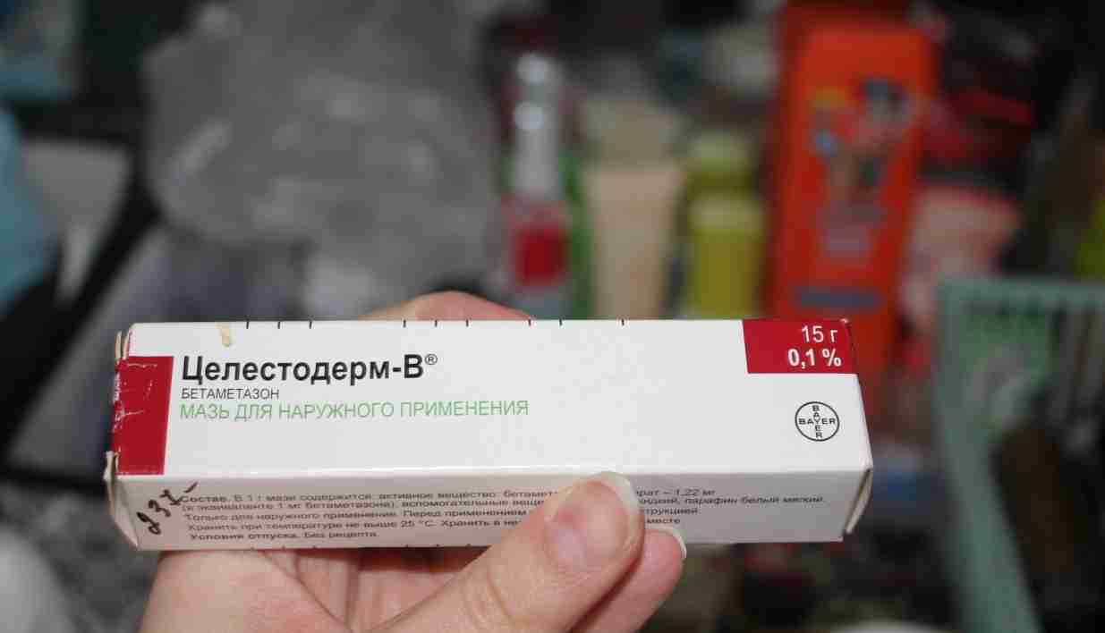 негормональные мази от экземы на ногах