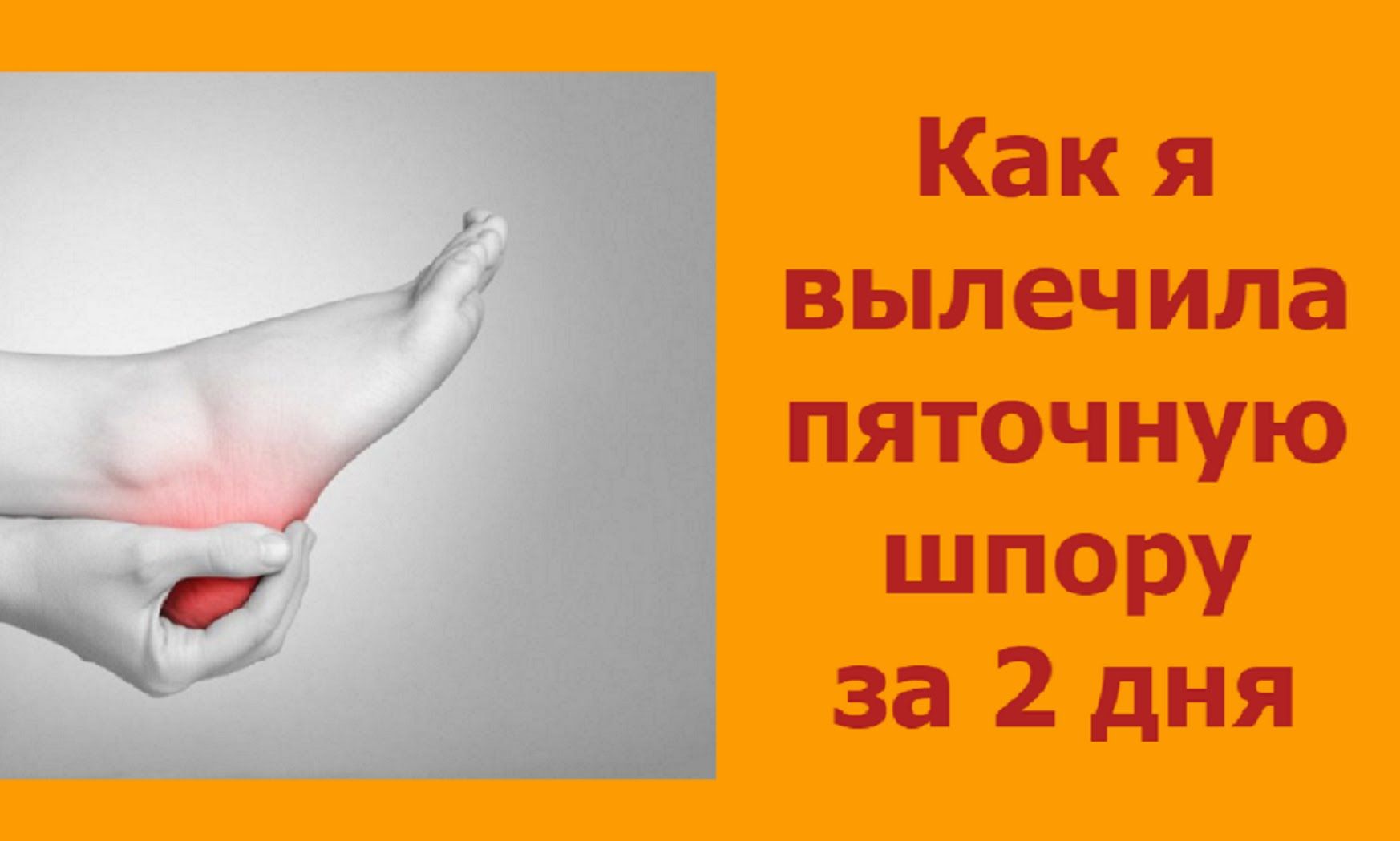 пяточная шпора как лечить современные методы