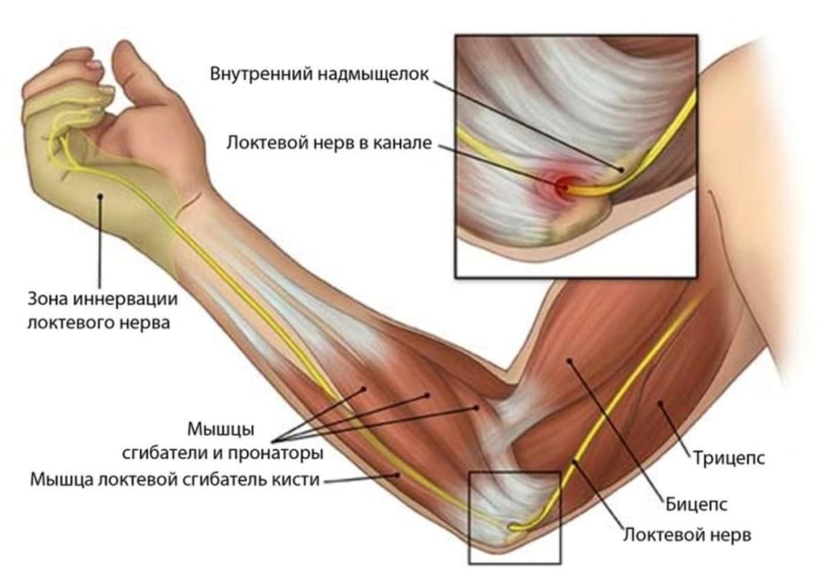 не поднимается левая рука болит плечо