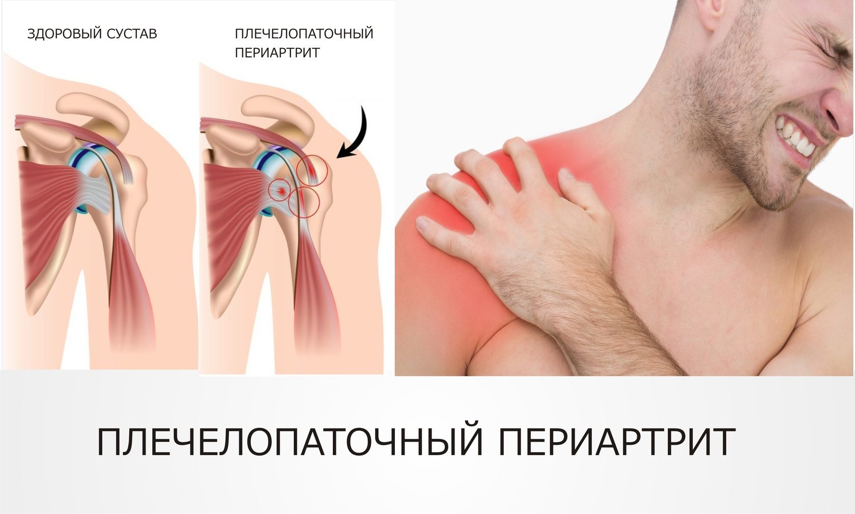 ноет плечо правое что делать