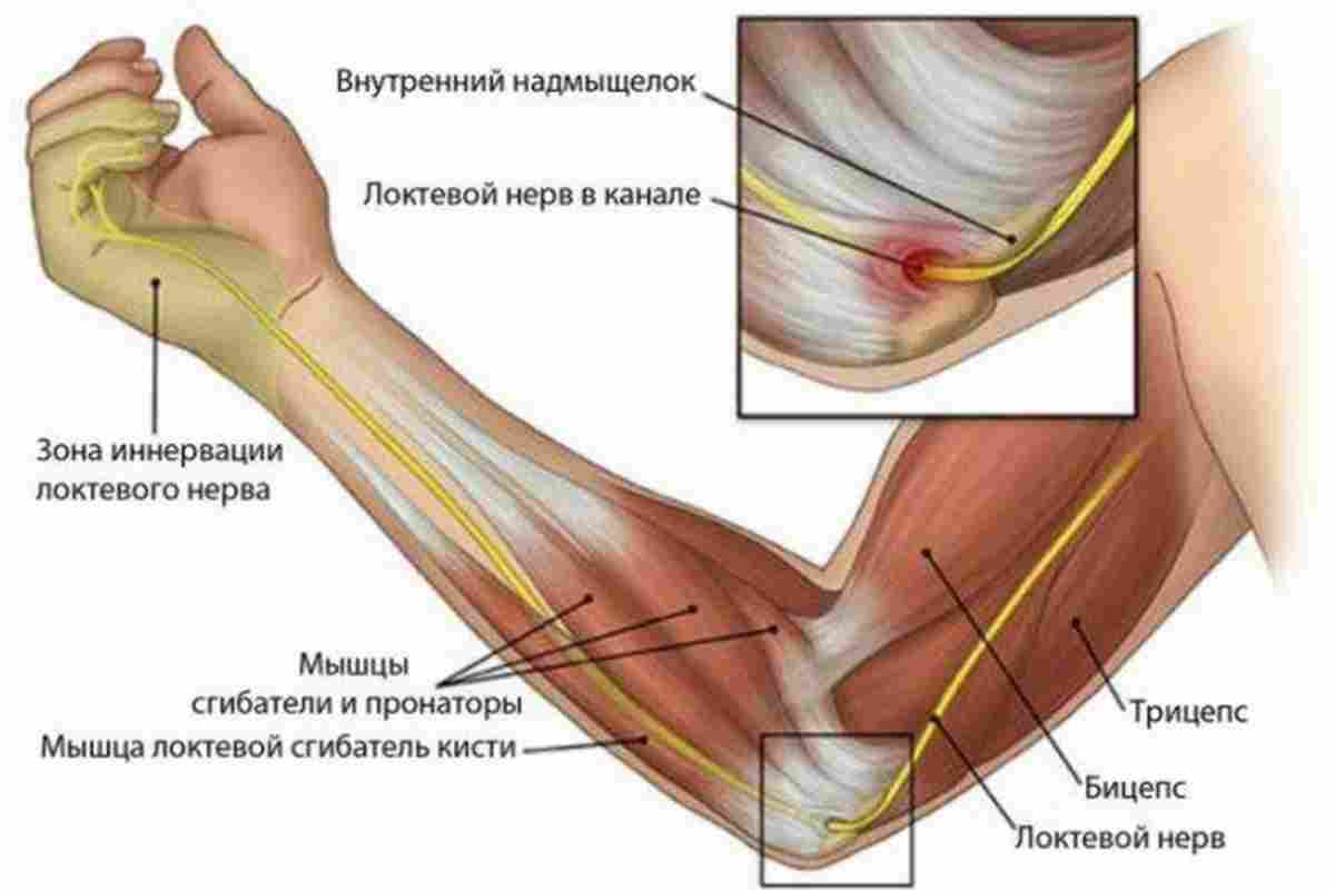 почему больно сгибать колено почему больно сгибать колено