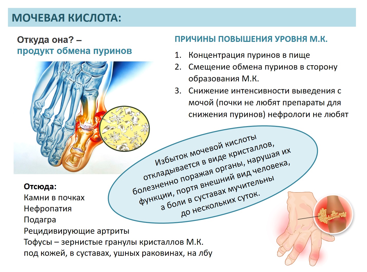 подагра народные средства лечения боли