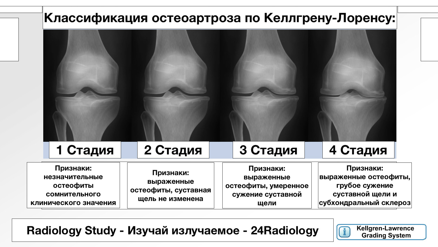 полиостеоартроз 1 степени что это полиостеоартроз 1 степени что это