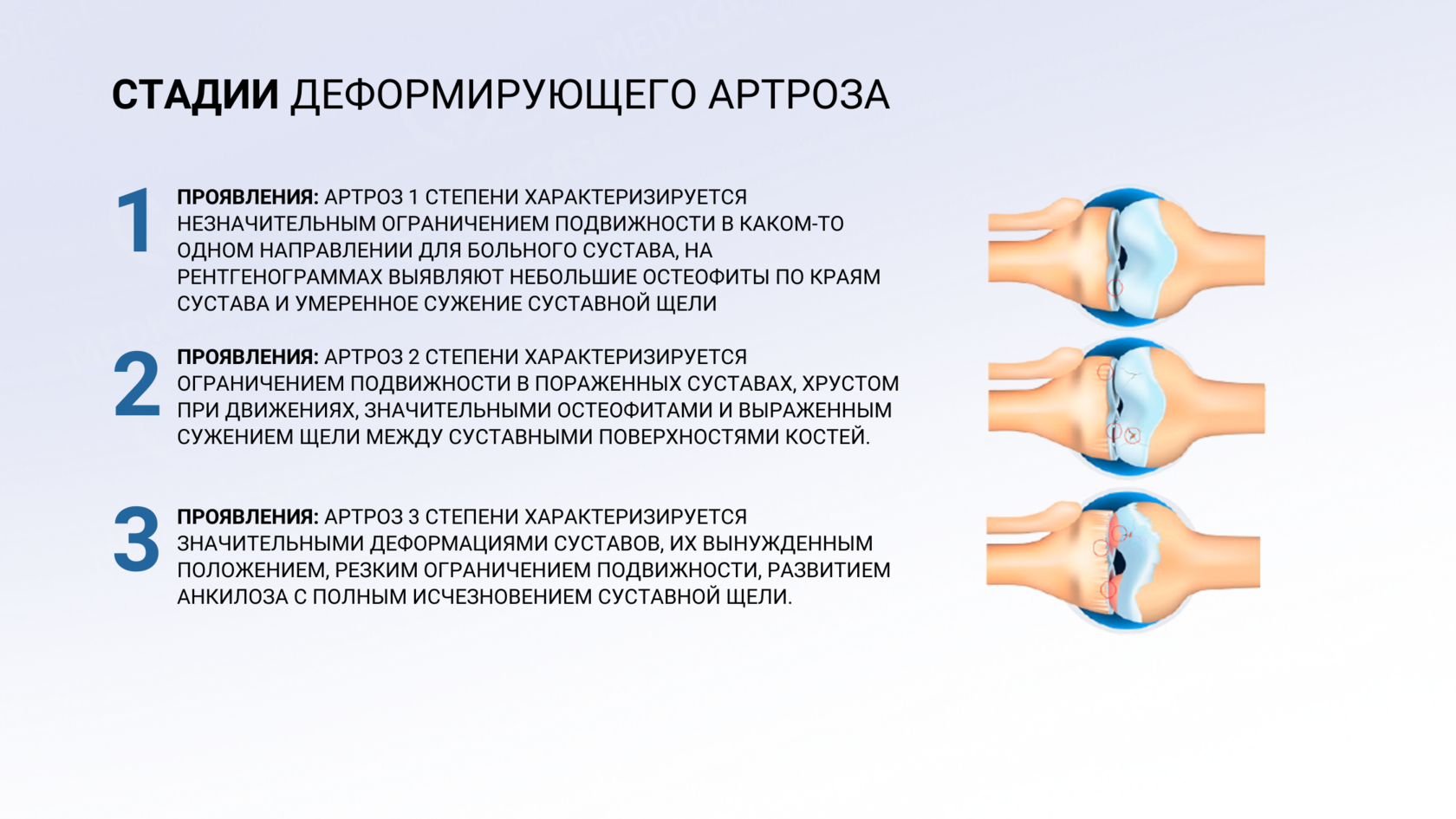 полиостеоартроз 1 степени что это полиостеоартроз 1 степени что это