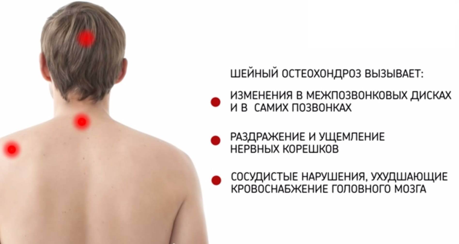 шейный остеохондроз симптомы причины лечение