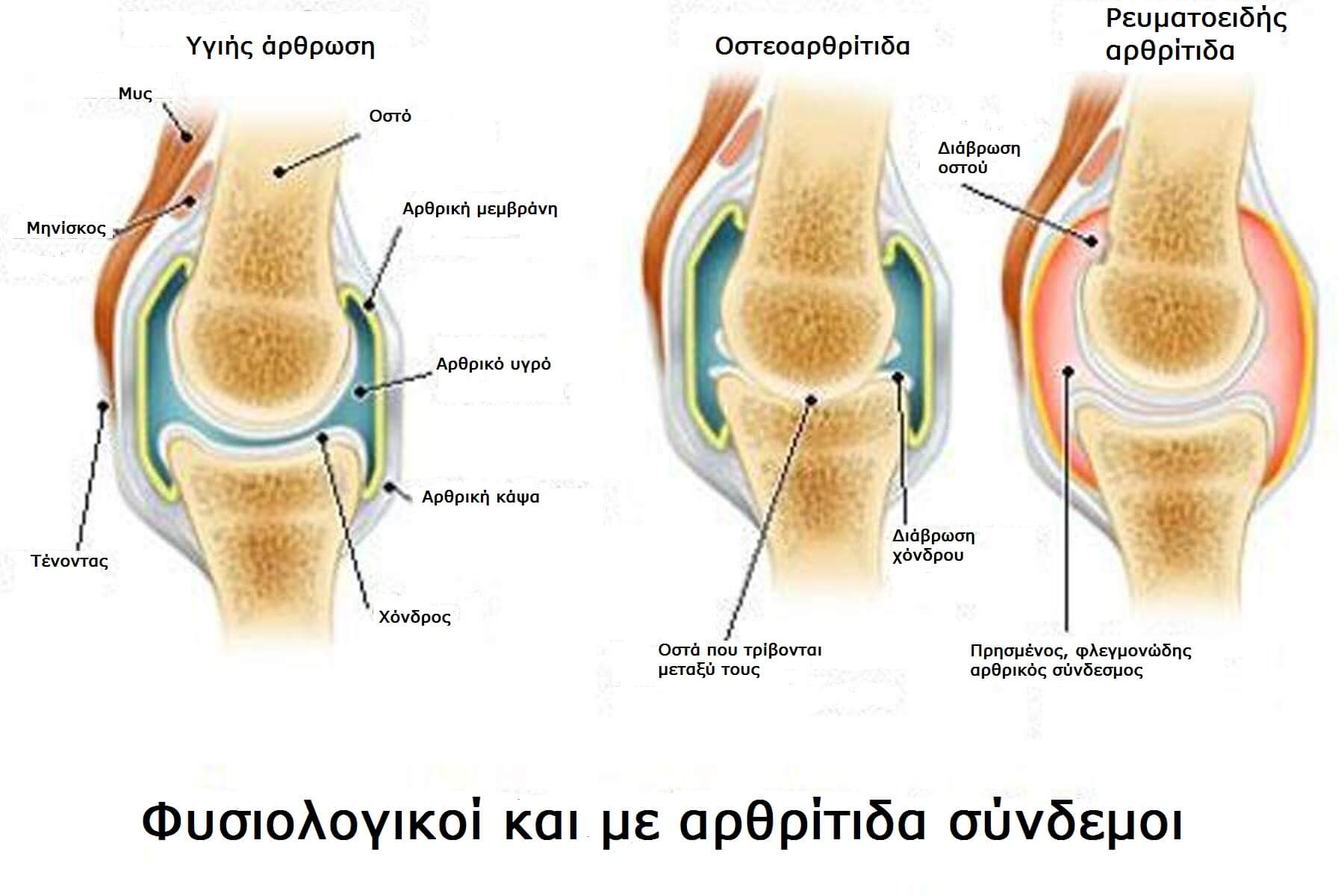 суставная жидкость колено