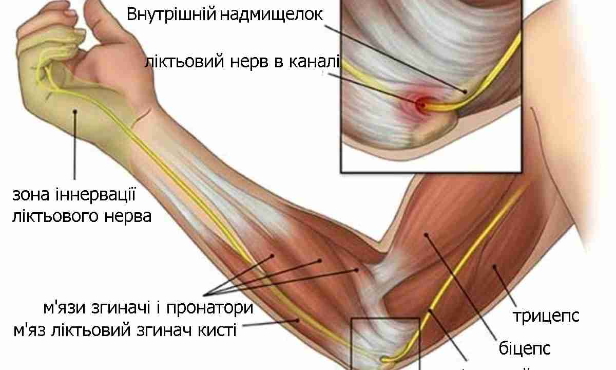 ударила локоть болит при сгибании