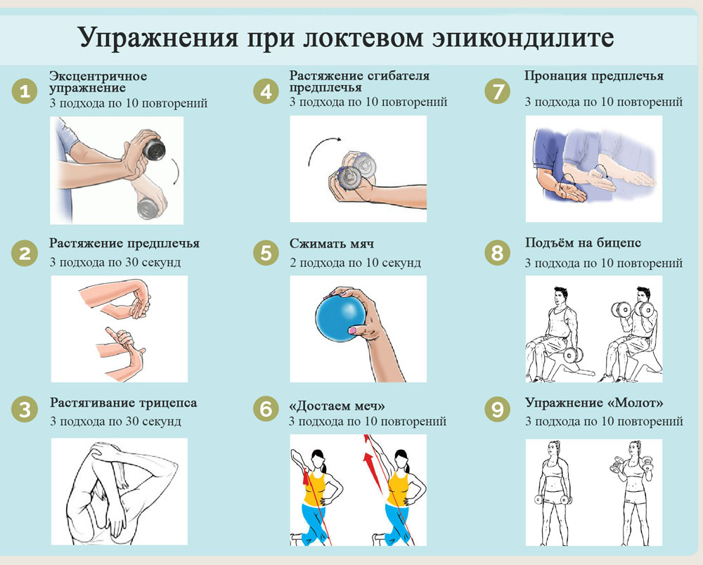 внутренний эпикондилит локтевого сустава