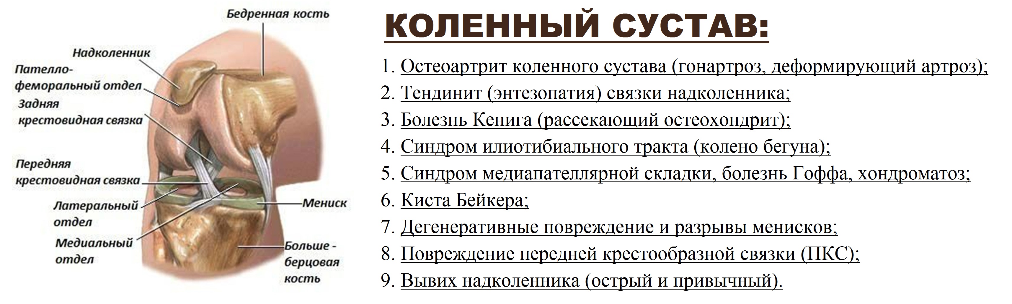 дегенеративное изменение медиального мениска 2 степени дегенеративное изменение медиального мениска 2 степени