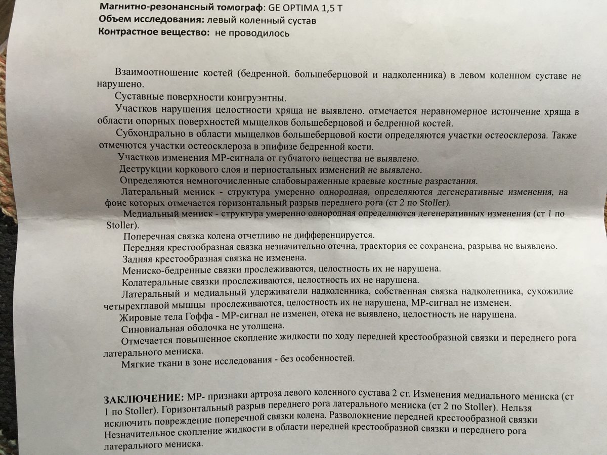 мр картина дегенеративных изменений заднего рога медиального мениска мр картина дегенеративных изменений заднего рога медиального мениска