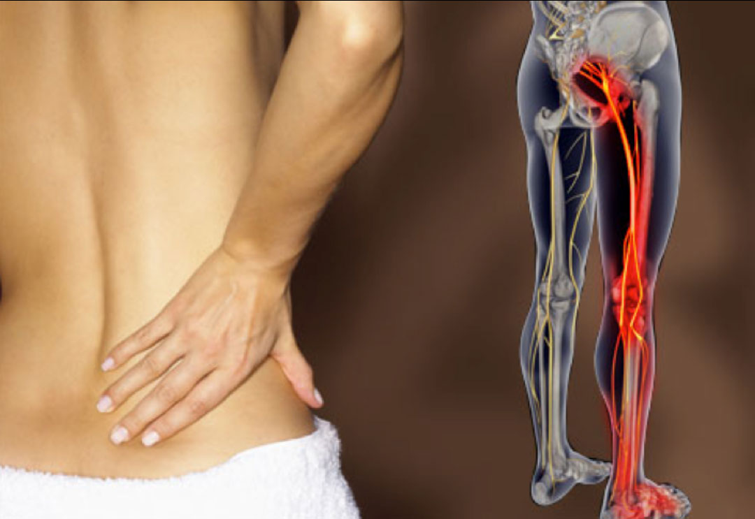 отнимается нога в тазобедренном