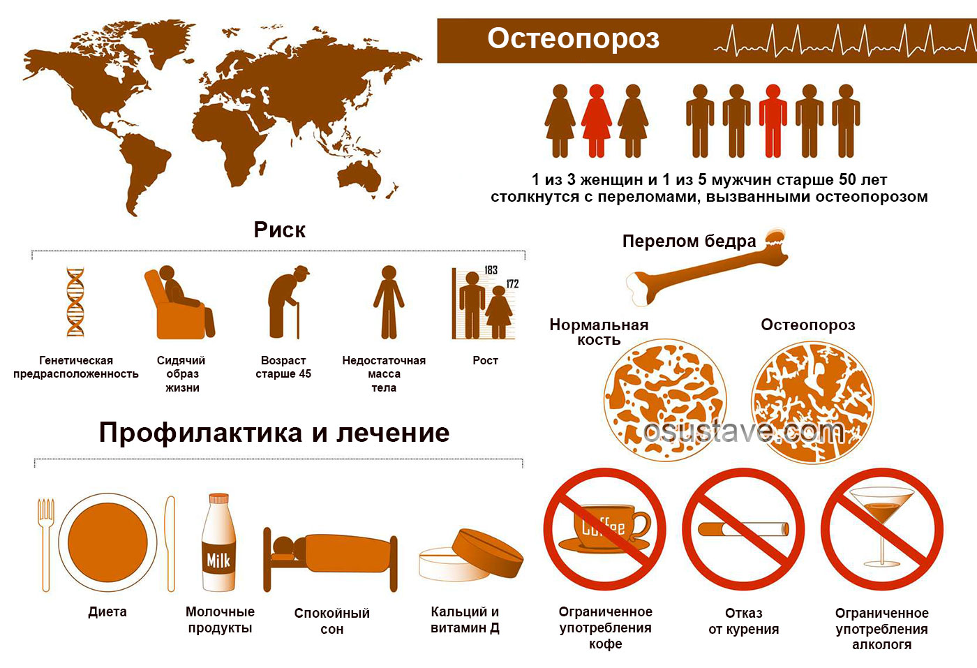 причины возникновения остеопороза у женщин