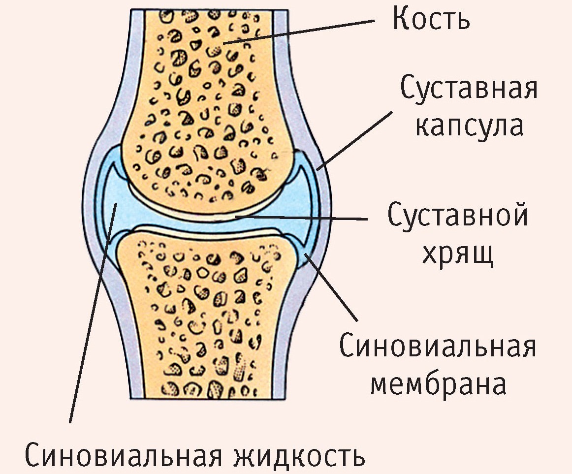собирается жидкость в коленном суставе