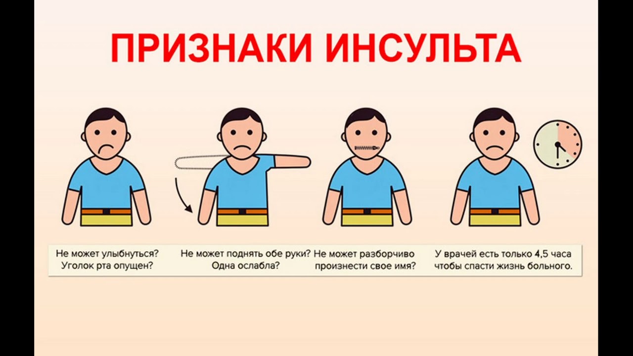 тяжело поднять левую руку тяжело поднять левую руку